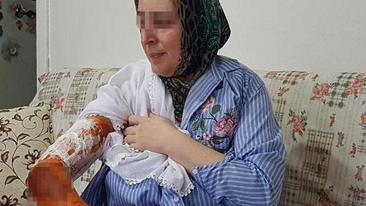 Dehşete düşüren olay! 17 yıllık eşi kaynar su ile haşladı