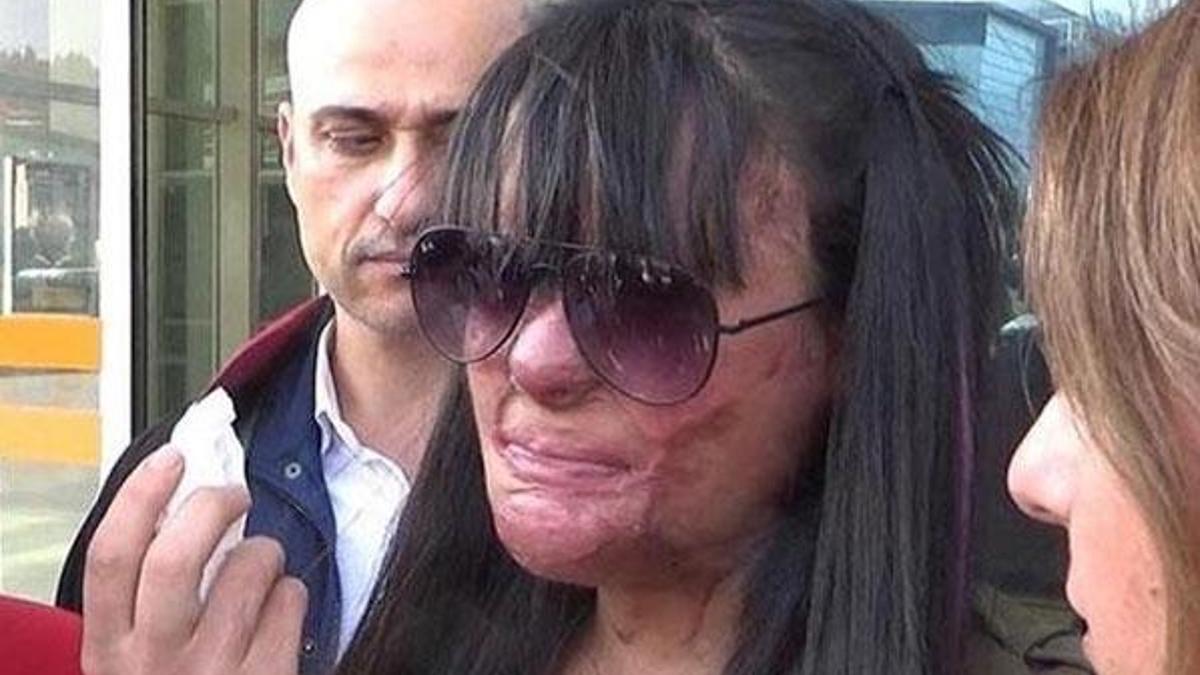 Berfin'in yüzünü asitle yakan caninin cezası belli oldu!