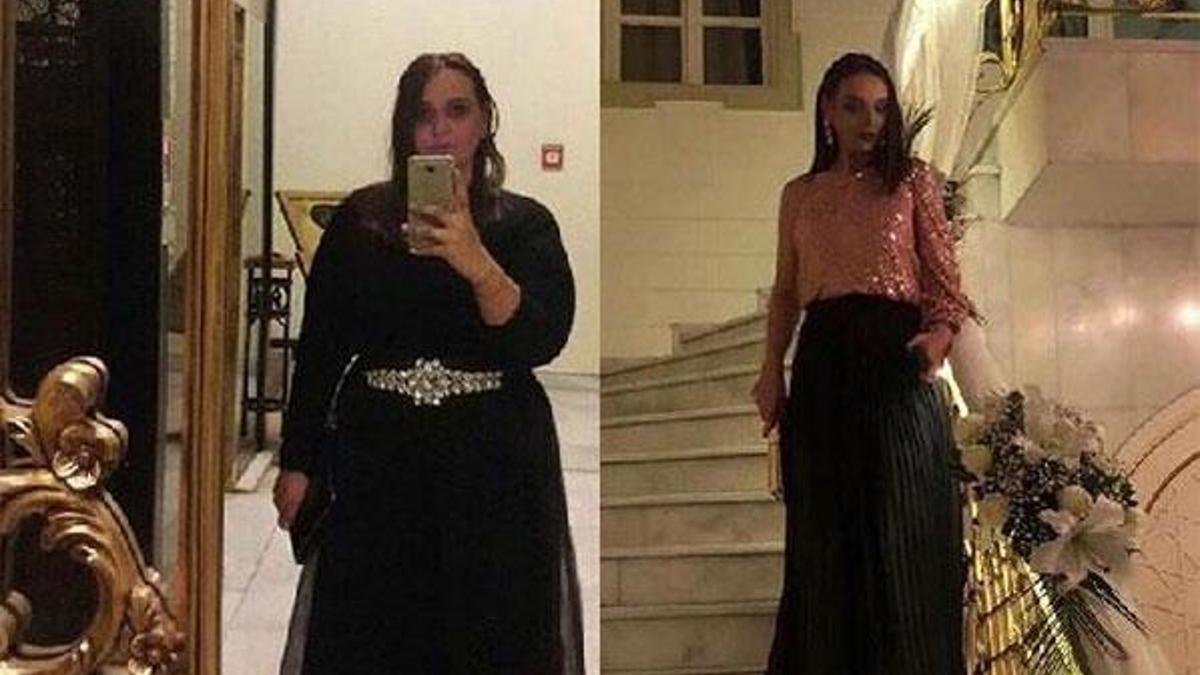 72 kilo veren genç kadın yeniden doğdu