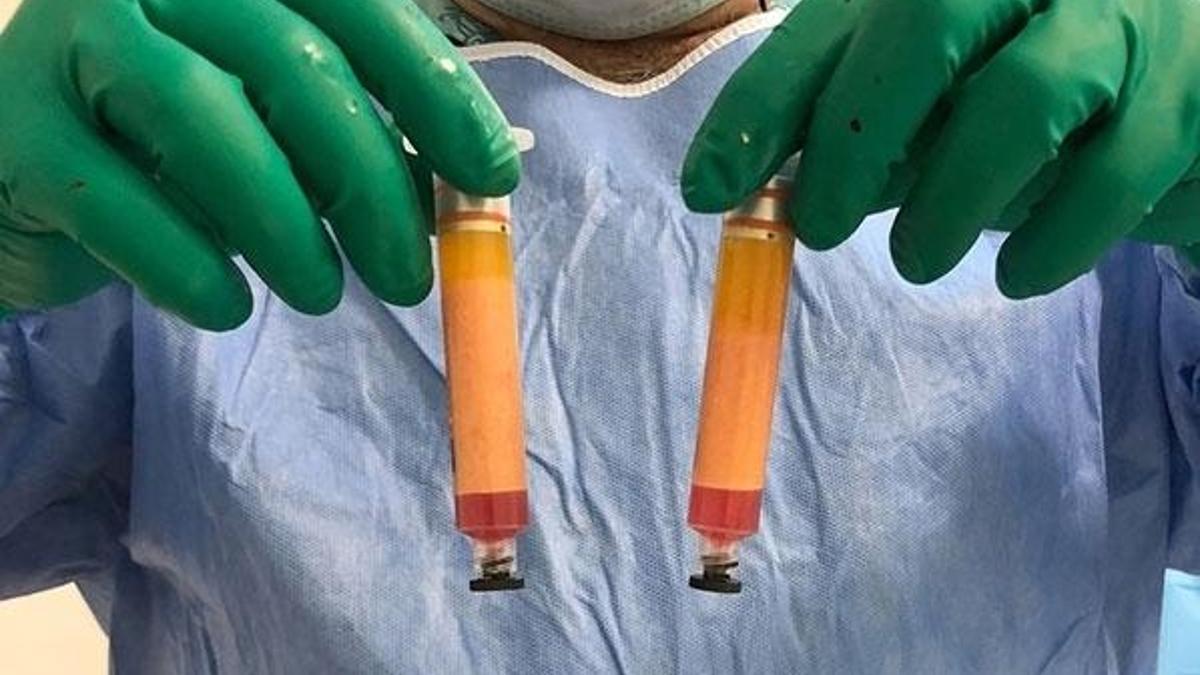 Parkinson'a erken yaşta yakalananlar dikkat!