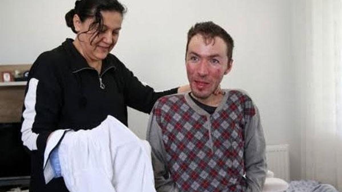 Anne ilgisiyle 31 yıldır hayata tutunuyor