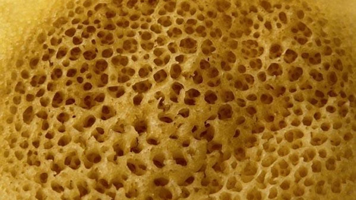 Tripofobi nedir, Tripofobi (delik fobisi) neden olur? Tripofobi belirtileri nelerdir?