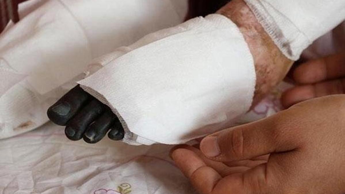 Nadir hastalık kız çocuğunu eve mahkum etti!