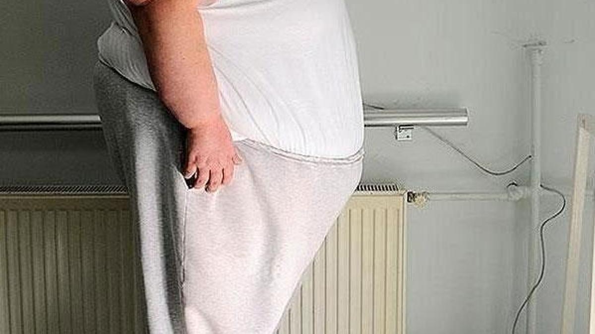 Türk Cerrahi derneklerinden obezite açıklaması