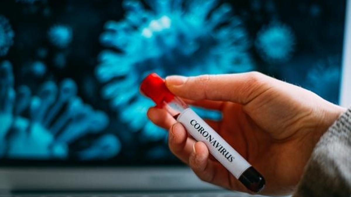 Corona virüsü testi nerede (sağlık kurumu ve il sağlık) yapılır? Test sonucu pozitif çıkarsa ne olur? Sağlık Bakanlığı Corona virüsü rehberi…