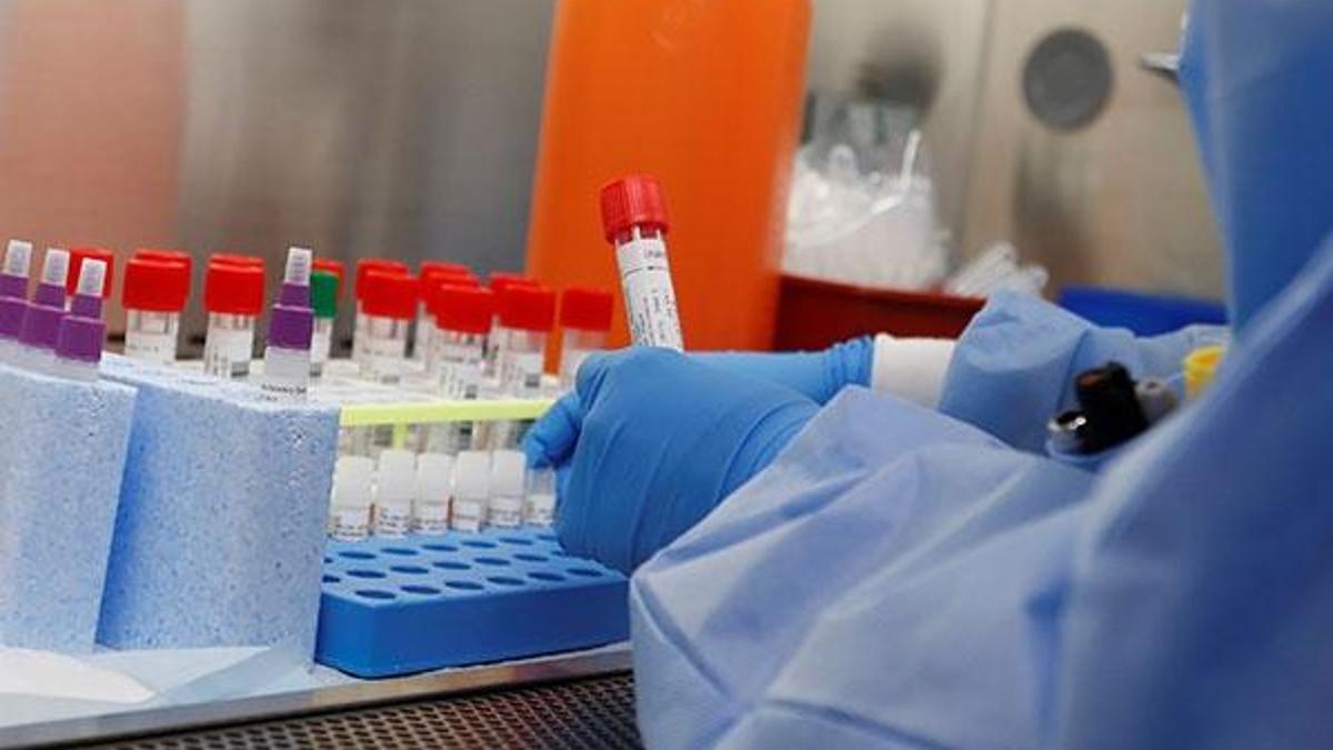 Corona virüs için flaş iddia: Aşısı bulundu