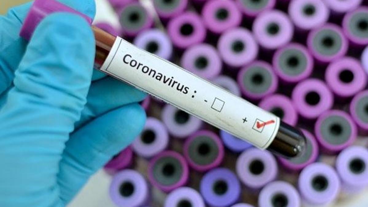 Corona virüs Türkiye'ye nasıl geldi?