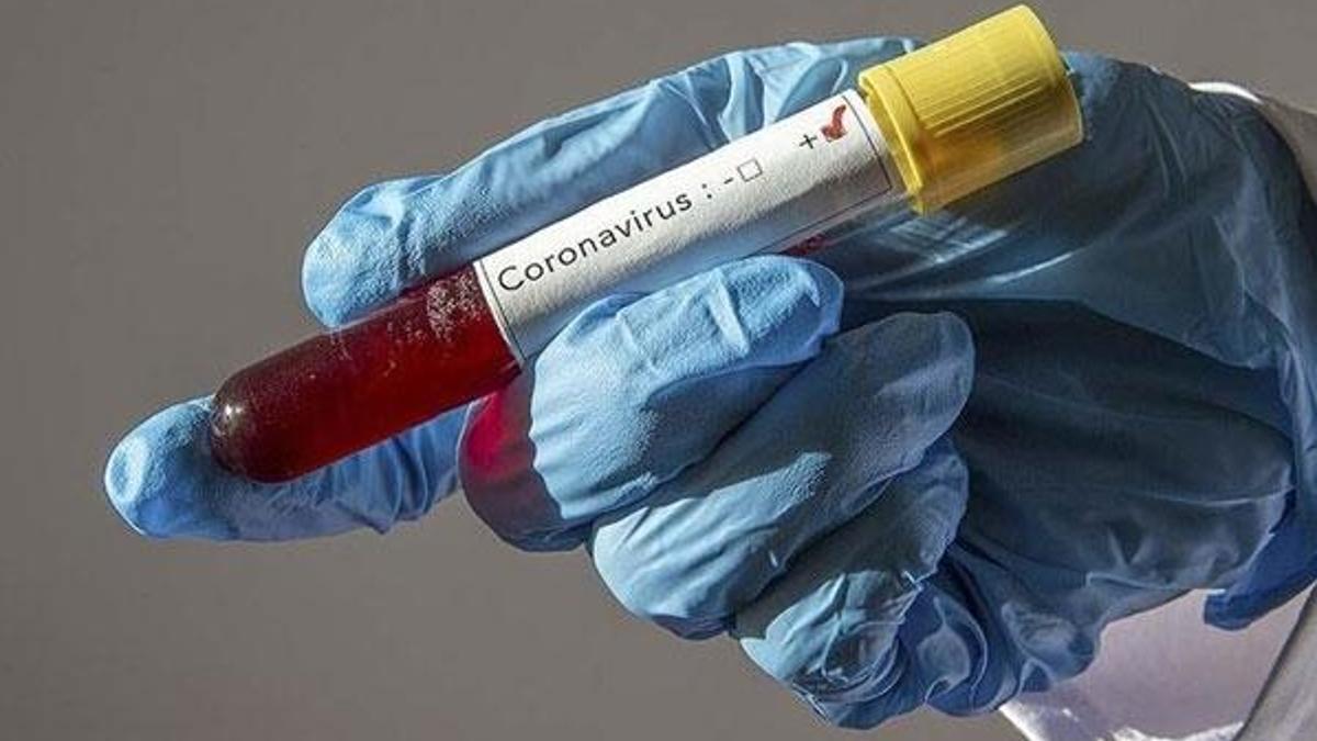 ABD'de yaşayan Türk çift, Kovid-19 test kiti üretti