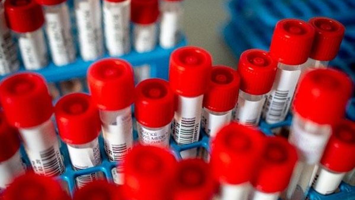 Corona virüs testi yaptıranlar sonuçlara "eNabız"dan ulaşabilecek