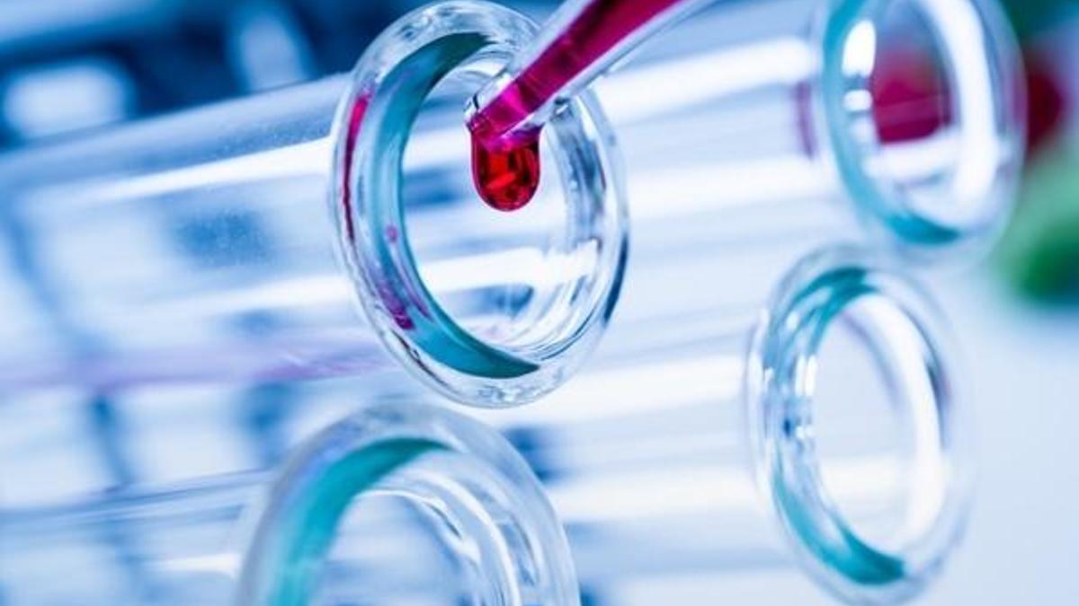 Online da corona virüsü testi yapılacak! Corona virüsü testi nasıl yapılır? Corona virüsü testi yapan hastaneler hangileri?