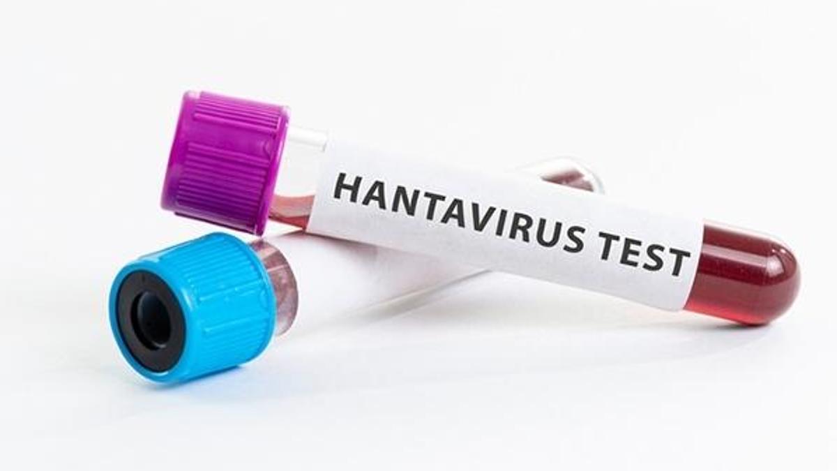 Hanta virüsü (hantavirüs enfeksiyonu) nedir, belirtileri nelerdir? Hanta Virüsü nasıl bulaşıyor? Çin'de yeni virüs ortaya çıktı!