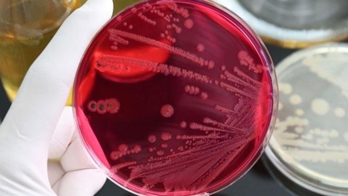 Fransa'da Salmonella bakterisi alarmı!