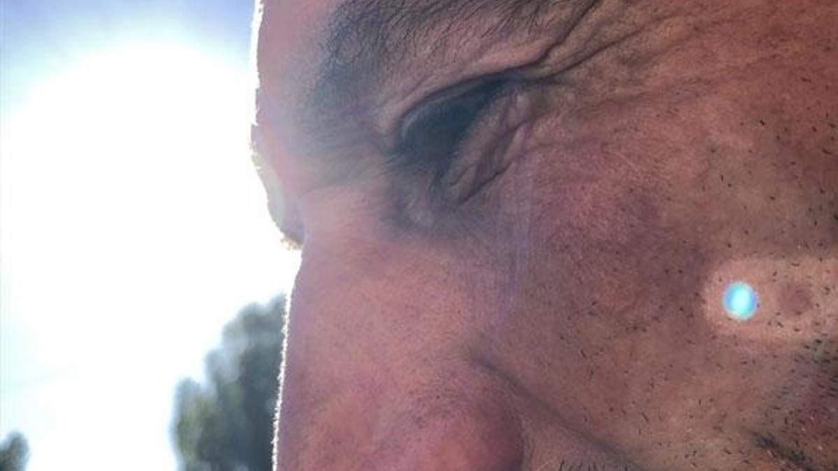 'Gök taşını izlerken gözümden rahatsızlandım'