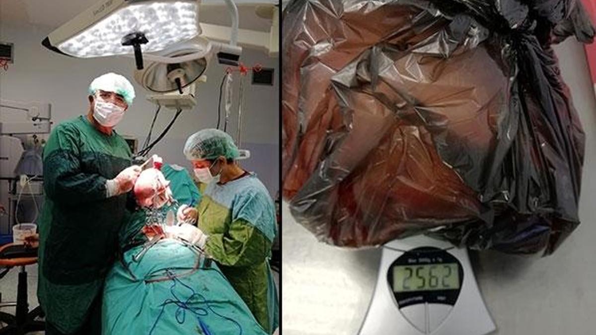 Doktorlar şoke oldu! Ağrı ve kanama şikayetiyle gitti...
