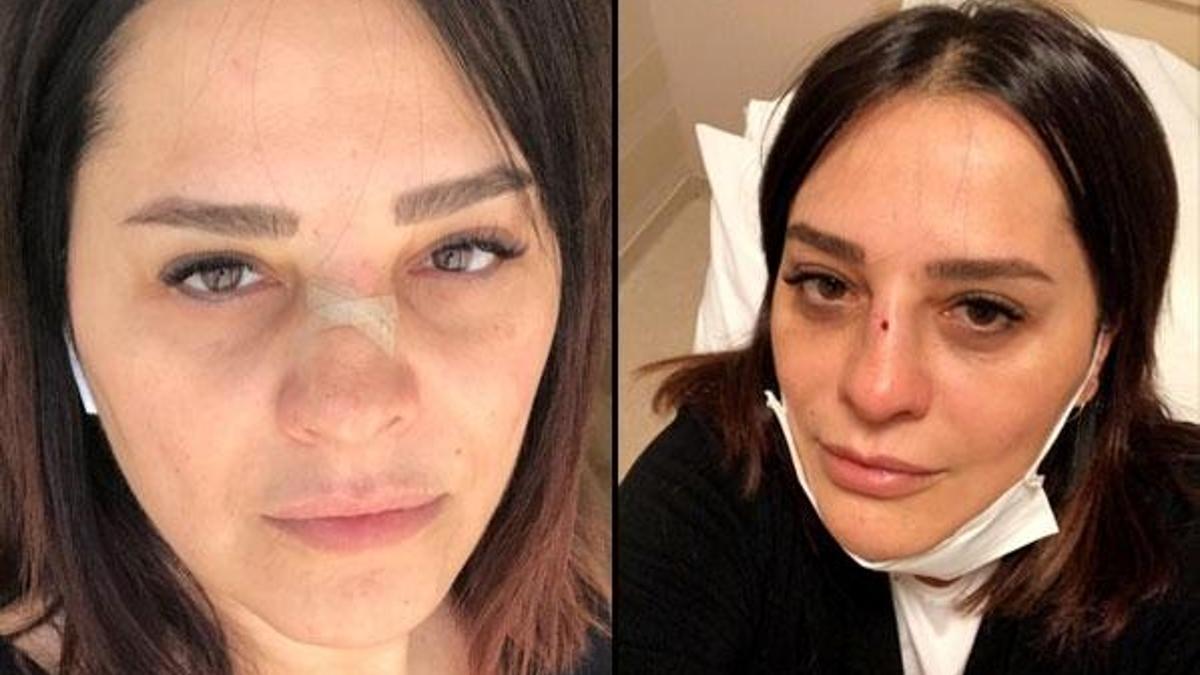 Reyhan Karaca korkuttu! Kanlar içinde kaldı