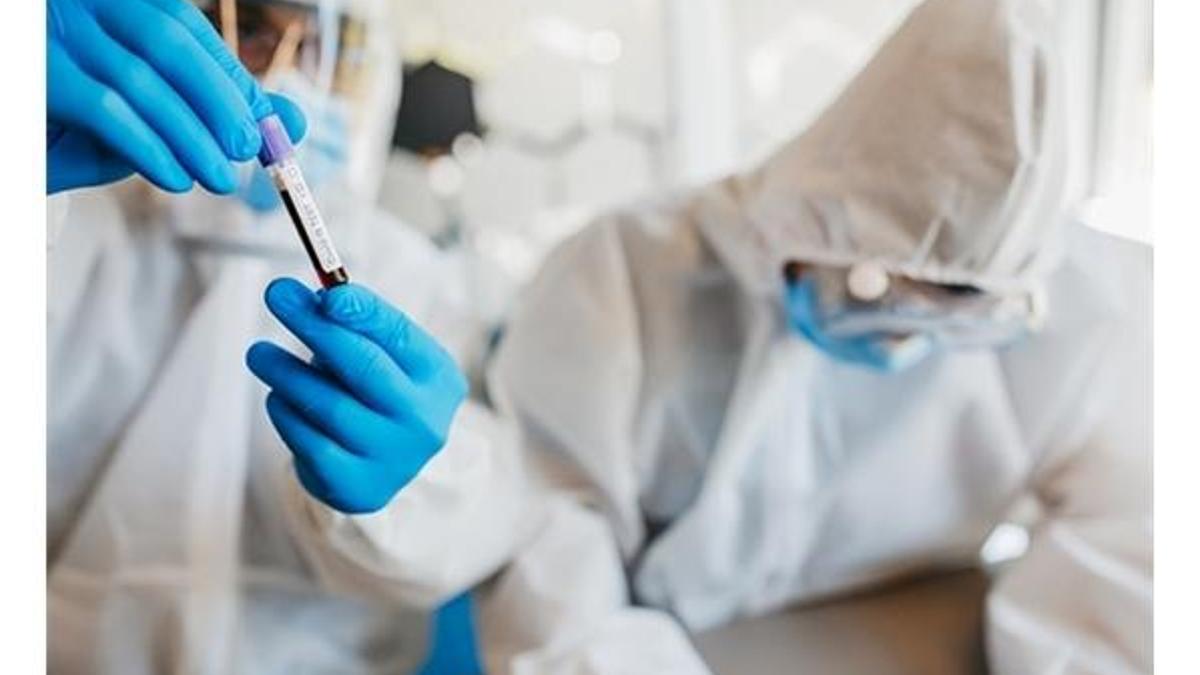 PCR ve Antikor testlerinin farkları nelerdir? PCR ve Antikor testleri hangi sonuçları veriyor?