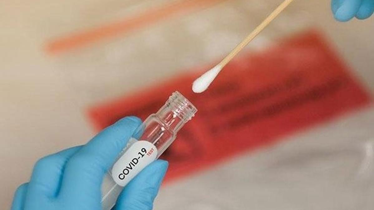 Antikorları saptayan birden fazla test var