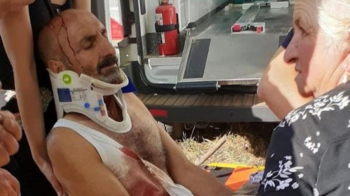 Tunceli'de ayı saldırısında 1 kişi yaralandı