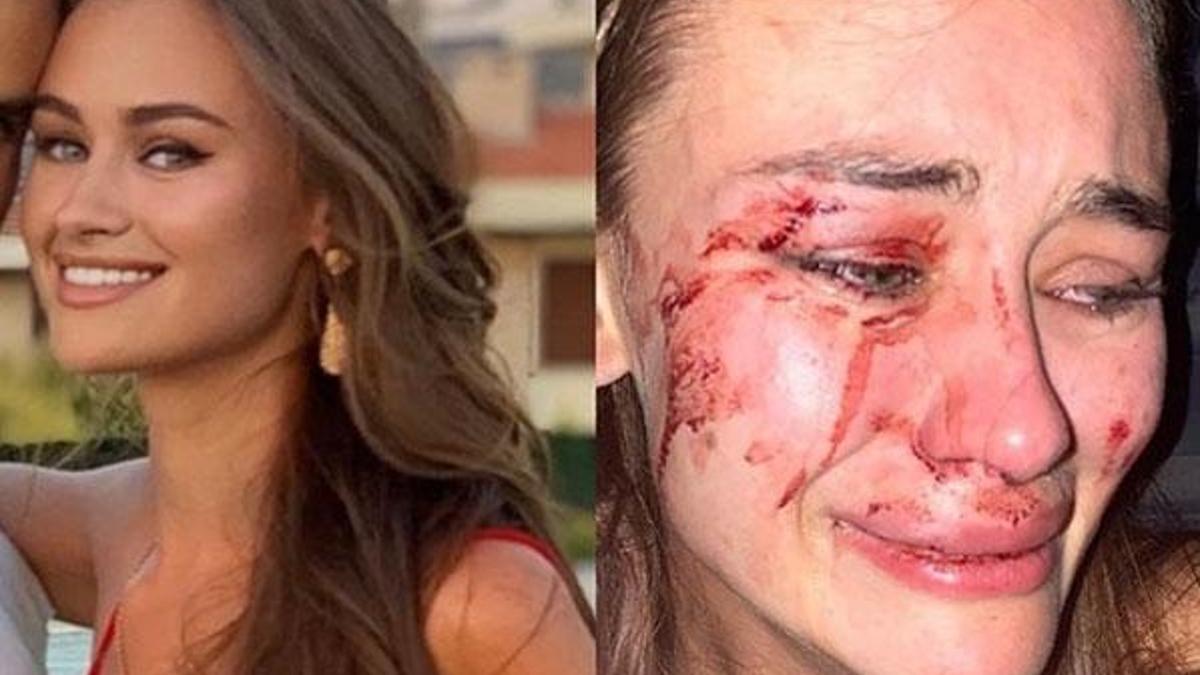 Ünlü model güvenlik görevlilerin saldırısına uğradı