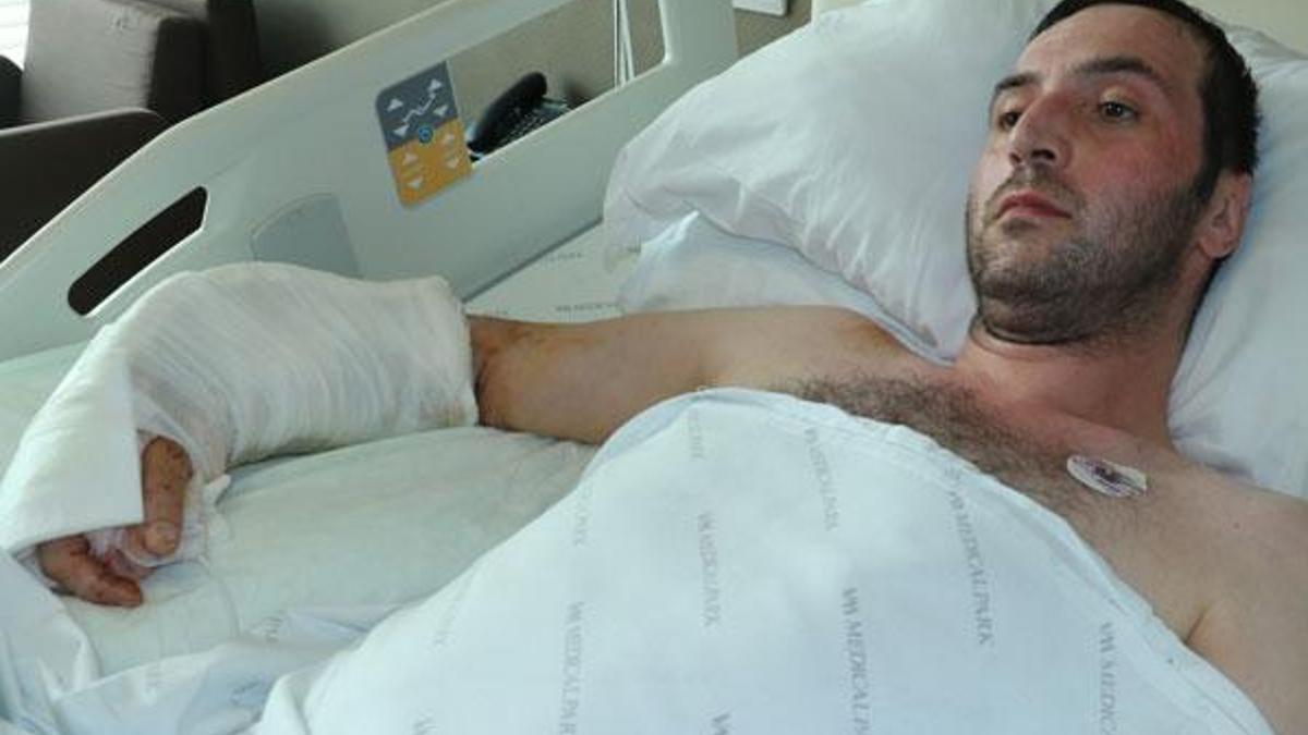 Fabrika işçisinin iş kazasında kopan kolu 12.5 saatte yerine dikildi