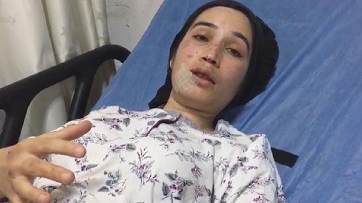 Otobüs kazasında yaralanan kadın: Acele ediyordu, biraz da hızlı sürüyordu
