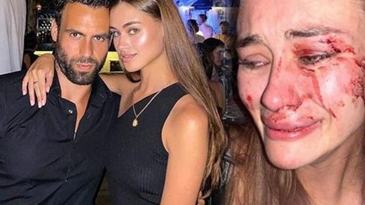 Ukraynalı model Daria Kyryliuk'ı kim darbetti? Görgü tanıkları anlattı