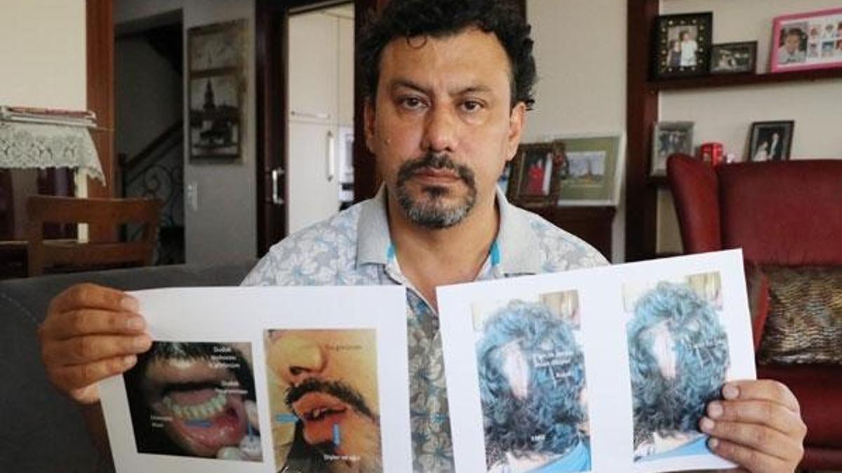 Denizli'de kalp cerrahına meslektaşının saldırı anı kamerada