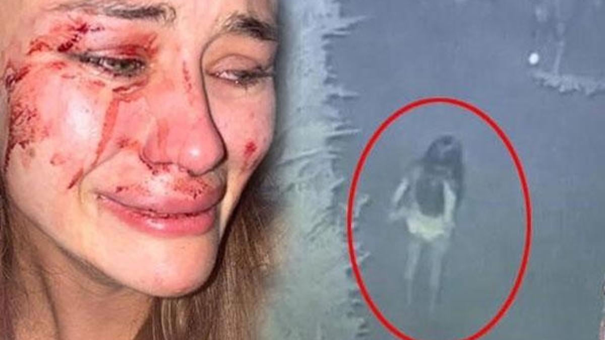 Dayak yiyen Ukraynalı modelin soruşturmasında flaş gelişme