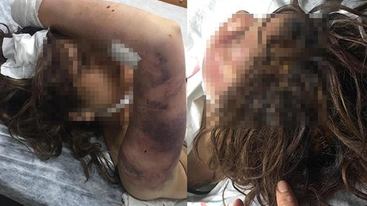 Dehşet evi! Eşini zincirle dövüp, tırnaklarını çekerek işkence yaptı