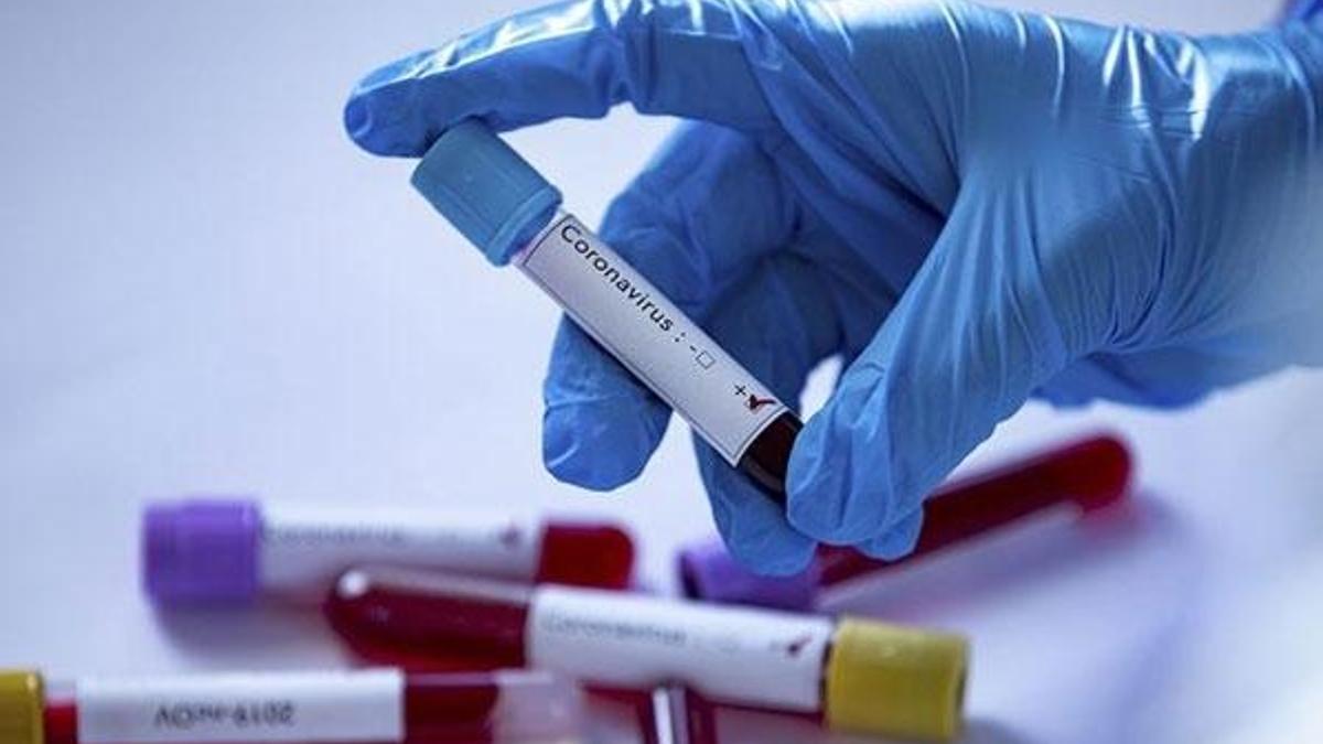 Aşk hormonu oksitosin Kovid-19'un tedavisi için potansiyel taşıyor