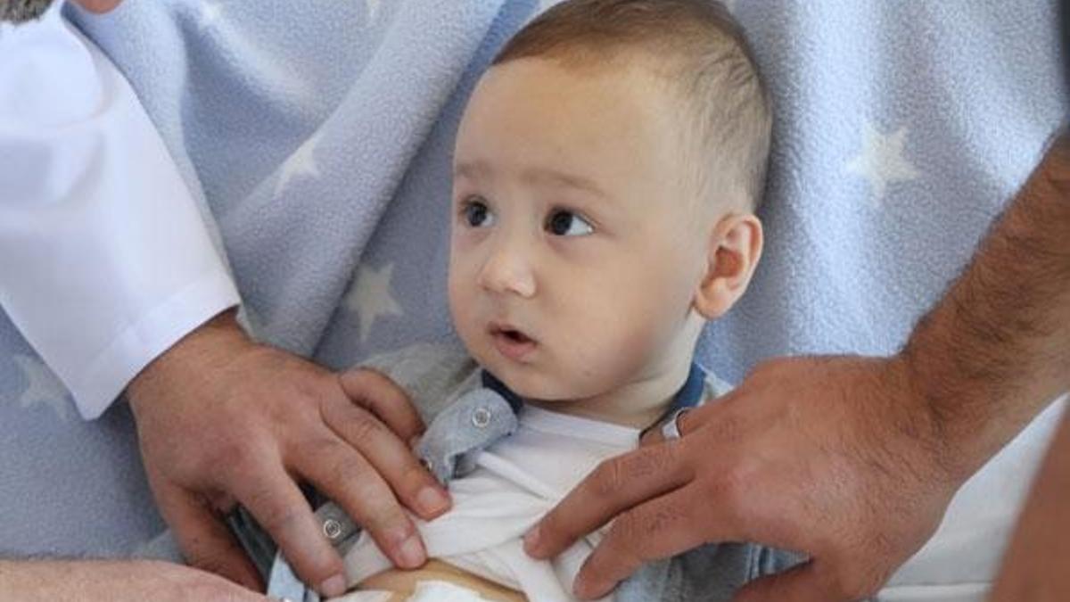 Bebeğin safra kesesinden 5 taş çıkarıldı