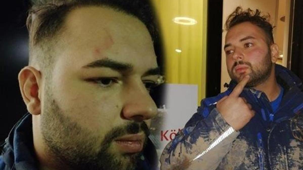 Almanya'da Türk iş insanına saldırıya Türkiye'den sert tepki!
