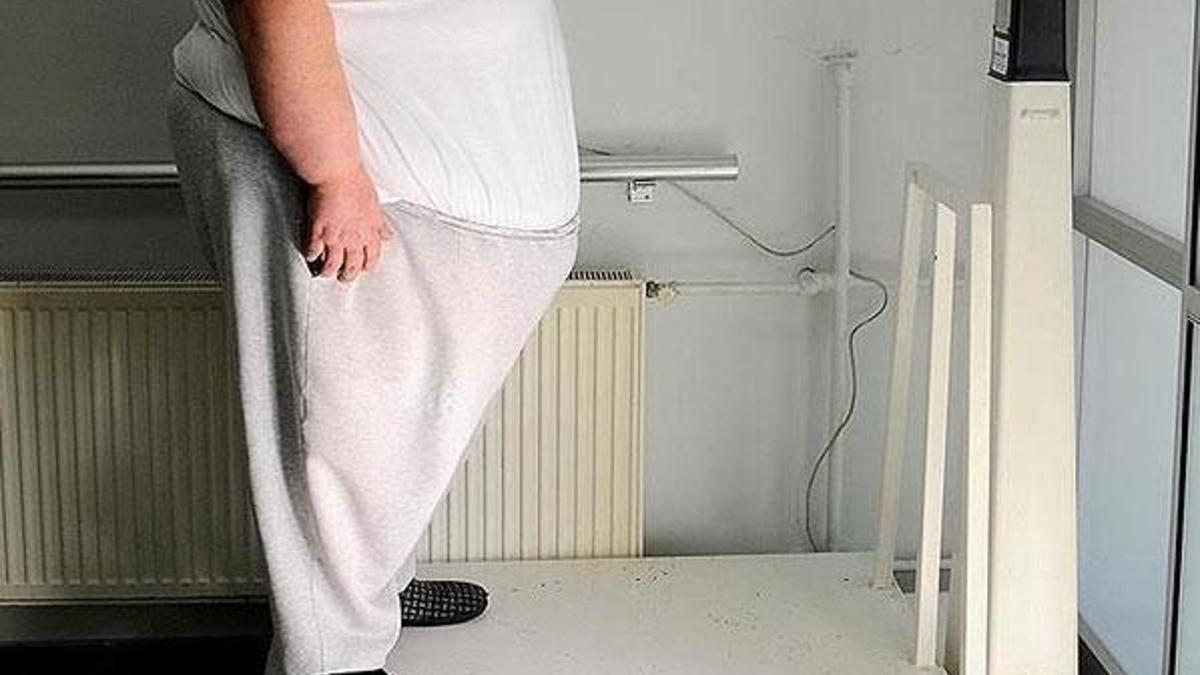 Obezite hastalarına Kovid-19 uyarısı