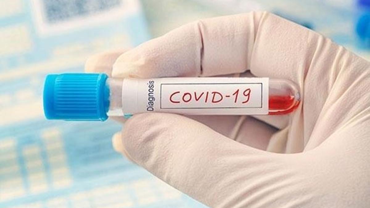 Prof. Dr. Çilingiroğlu, Covid-19 tedavisinin bulunduğunu iddia etti