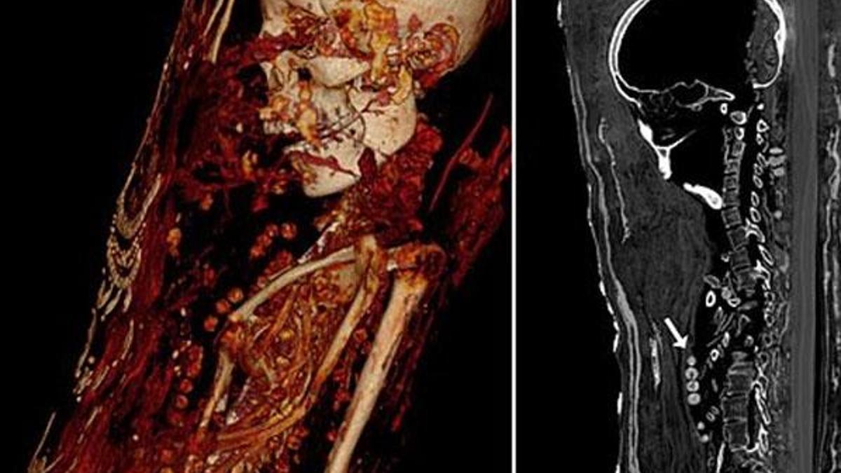 Bilgisayarlı tomografi mumyaların sırlarını ortaya çıkardı