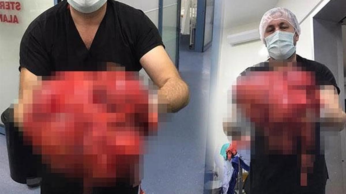 Doktorlar şoke oldu! Karın ağrısı şikayetiyle gitti...