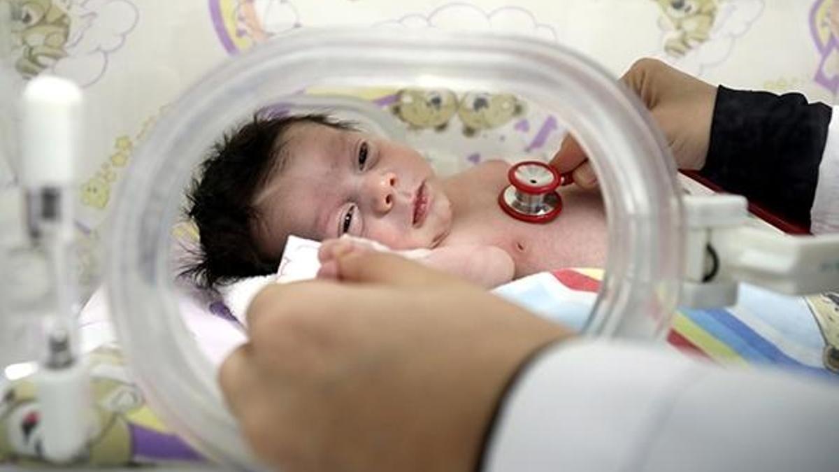 20 bin doğumda bir görülüyor! Tüm organları ters doğdu