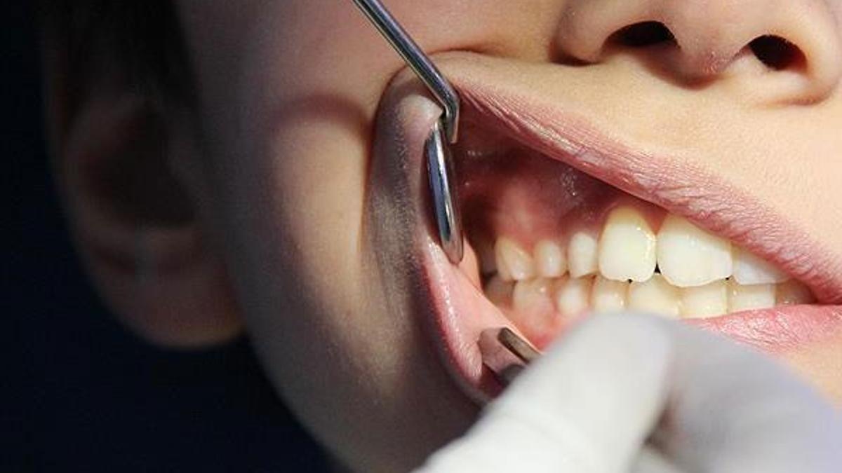 Diş sıkma alışkanlığı masseter botoks tedavisiyle son buluyor