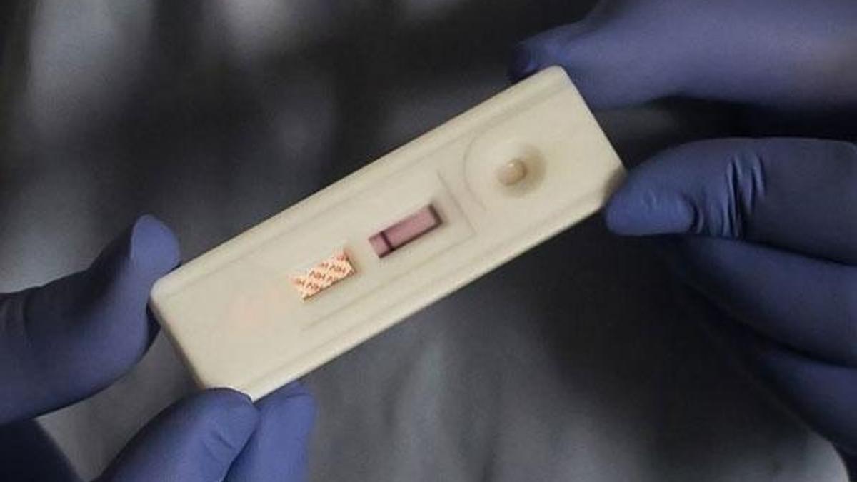 AIDS ile ilişkili hastalıklara bağlı ölüm oranları azaldı