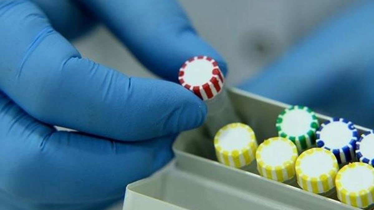 Türk hekim, Kovid-19'un tespiti için idrar kiti geliştirdi