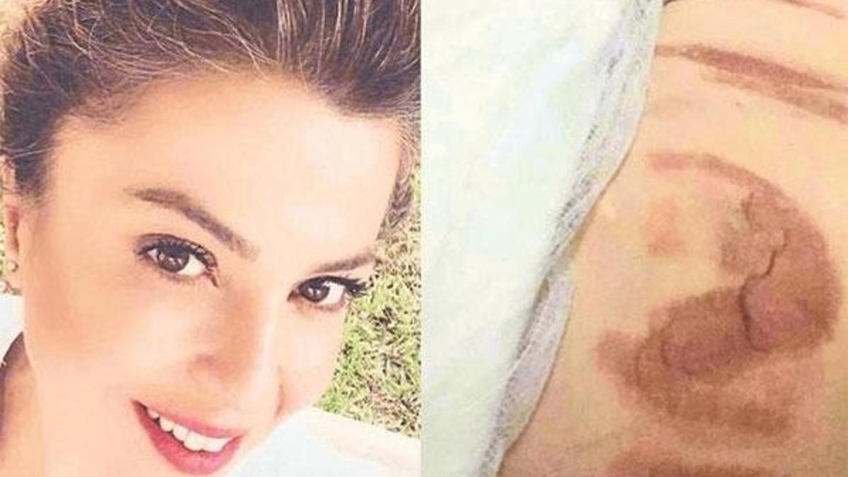 Esra Mansuroğlu estetik merkezine gitti! Hayatı kabusa döndü