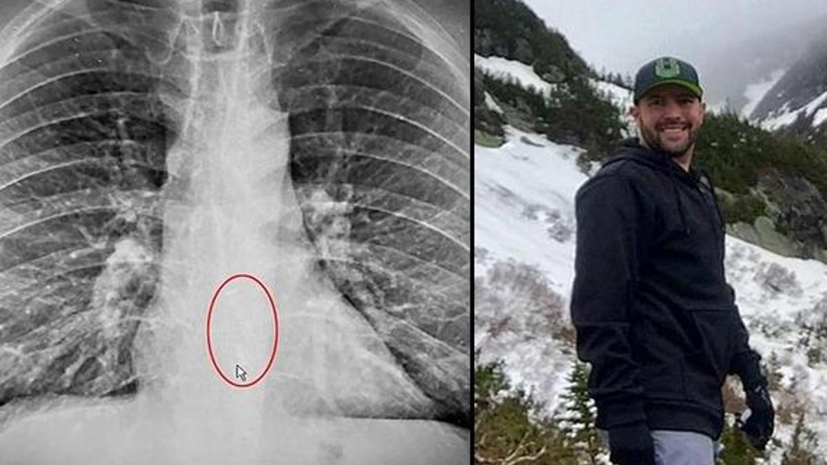 Şok eden olay! Uykusunda yuttu, sabah nefes alamadığında anladı...