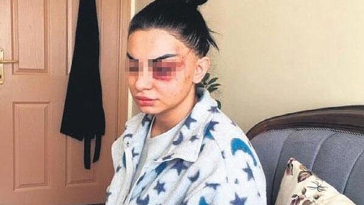 Genç hemşire büyük kabus yaşadı! 41 günlük eşi...