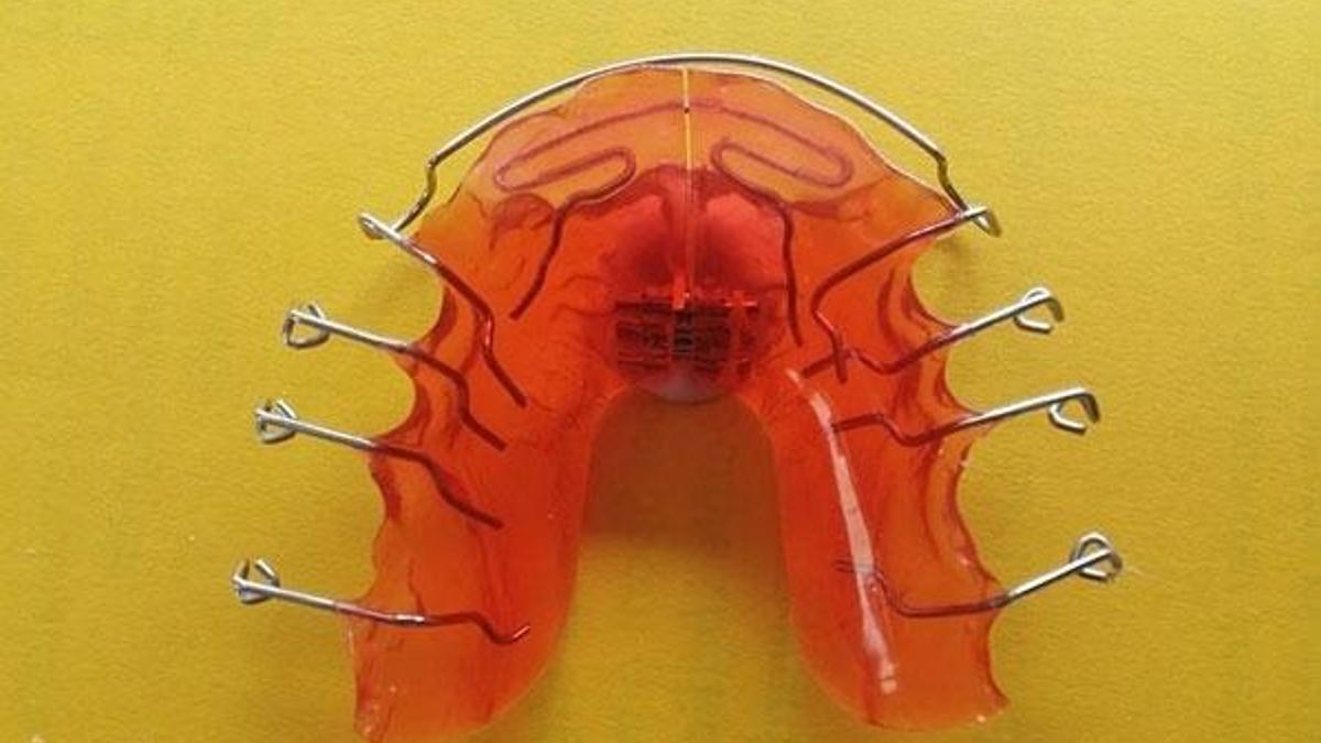 Yapay zeka ortodontik tedavilere de katkı sağlıyor