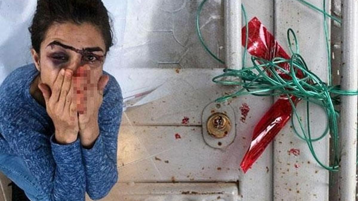 Melek İpek 112'yi arayarak yardım istemiş: 'Kocamı vurdum, çabuk yetişin'