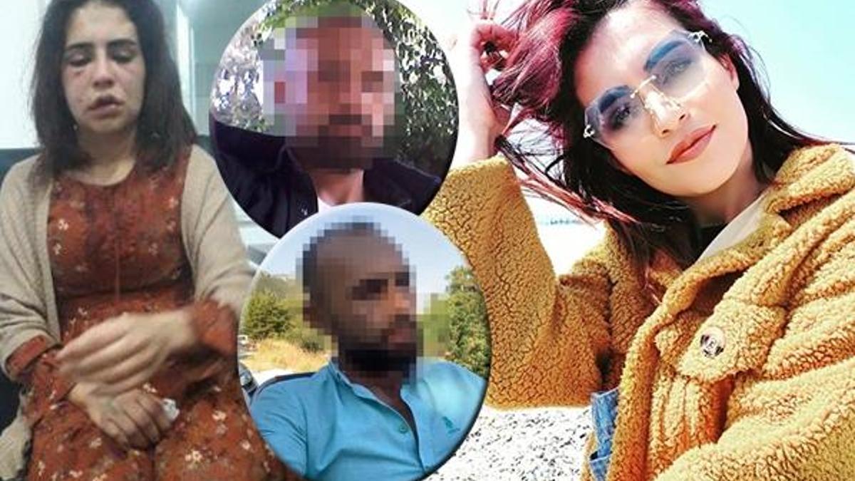 Eski sevgili dehşeti! Yüzünü tanınmaz hale getirdi... 'Ne olur yardım edin!'