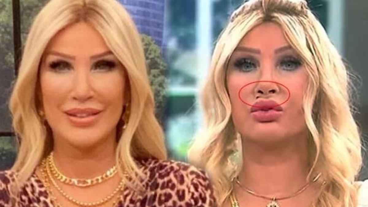 Seda Sayan'ın yüzündeki değişiklik dikkat çekmişti! Ortaya çıktı, sebebi...
