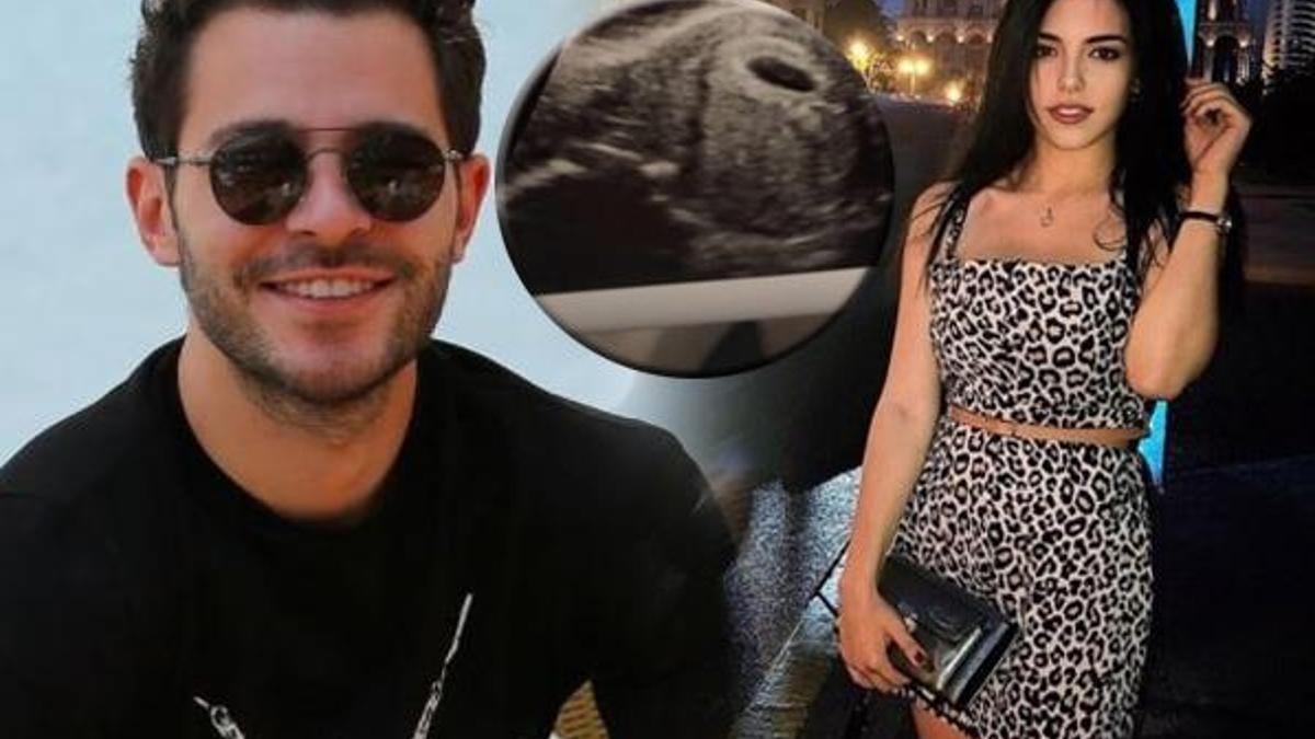 Aygün Aydın'dan 'hamileyim' iması! Ultrason görüntüsünü paylaştı: 3 aylıkmış
