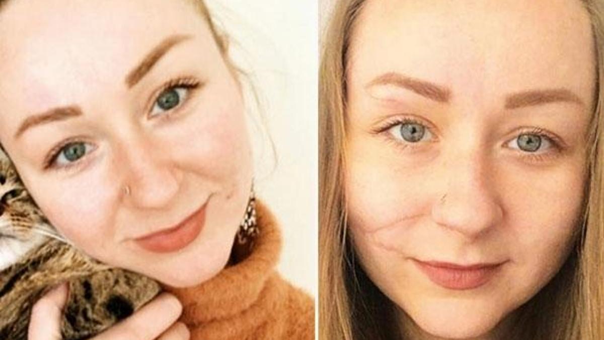 Boşanmak istedi, ölümden döndü... Ukraynalı Hanna kendine yeni bir hayat kurdu