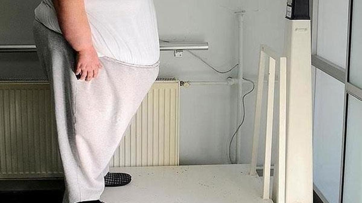 Hastaneye yatanların yaklaşık yarısı obezite hastası